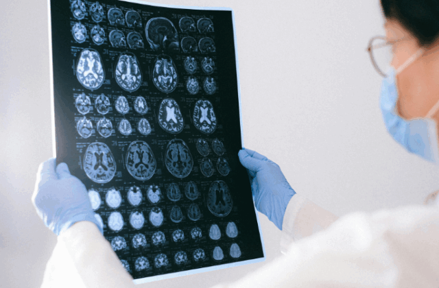 Clarity Around Concussion: What CBI-M Means for Awareness, Diagnosis & Recovery